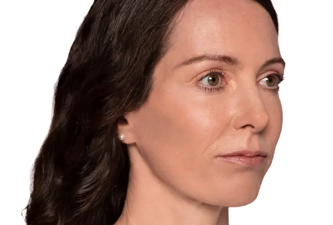 SANT Aesthetics & Regenerative Medicine after — Portland, OR