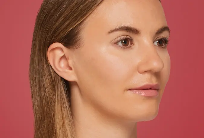 SANT Aesthetics & Regenerative Medicine after — Portland, OR