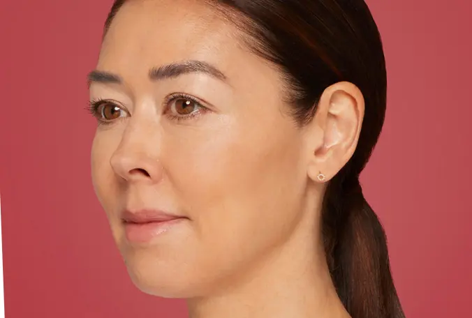 SANT Aesthetics & Regenerative Medicine after — Portland, OR