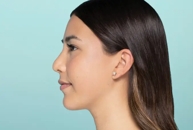 SANT Aesthetics & Regenerative Medicine after — Portland, OR