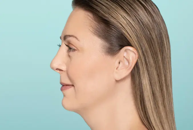 SANT Aesthetics & Regenerative Medicine after — Portland, OR