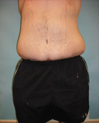 Sean T. Lille, MD, PC after — Scottsdale, AZ