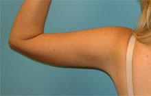 Sean T. Lille, MD, PC after — Scottsdale, AZ