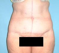 Sean T. Lille, MD, PC after — Scottsdale, AZ