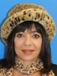 Jhonny A. Salomon Plastic Surgery & Med Spa fat transfer after — Miami, FL