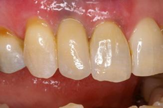 OC Dental Specialists | Emergency & Cosmetic Dentist Irvine smile makeover after — Irvine, CA