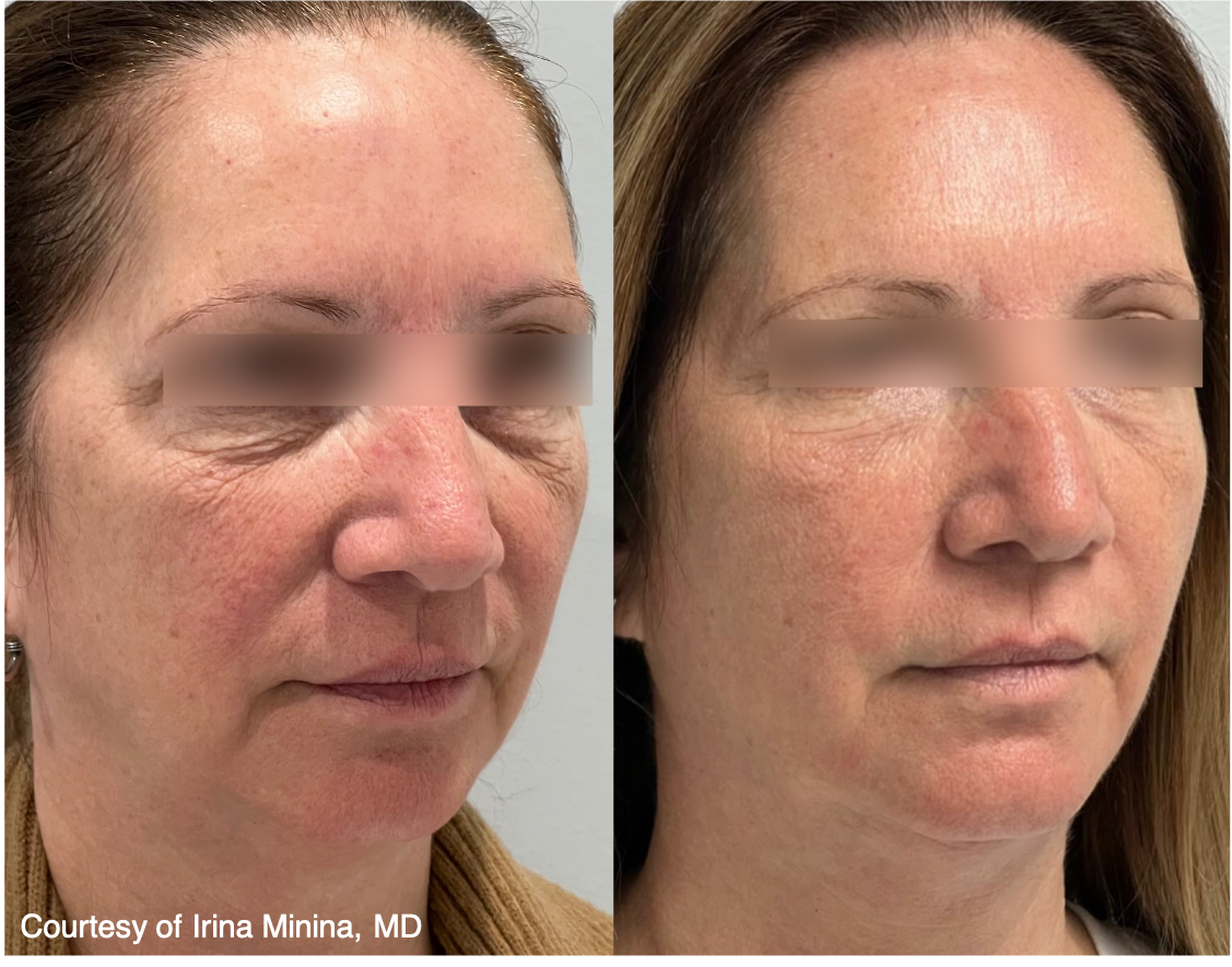 Arlani Integrative Medicine and Medspa result — Murray, UT
