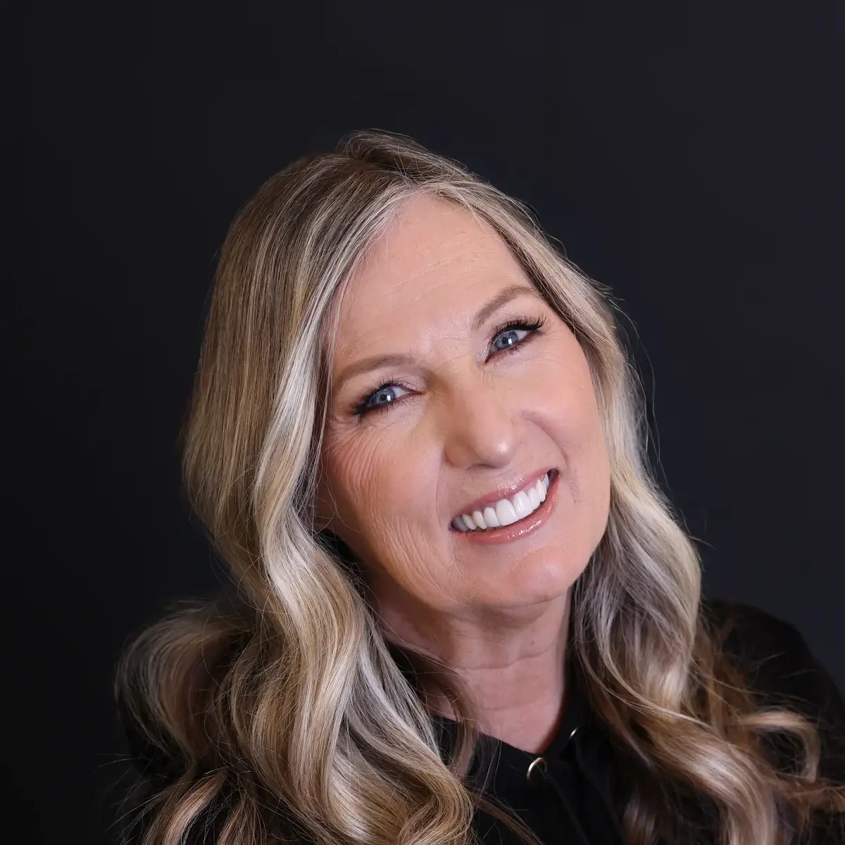 Intermountain Smiles smile makeover after — Sandy, UT