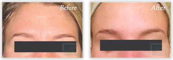 Lupo Center for Aesthetic and General Dermatology result — New Orleans, LA