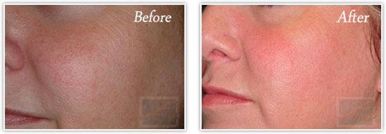 Lupo Center for Aesthetic and General Dermatology result — New Orleans, LA