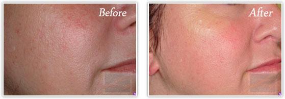 Lupo Center for Aesthetic and General Dermatology result — New Orleans, LA