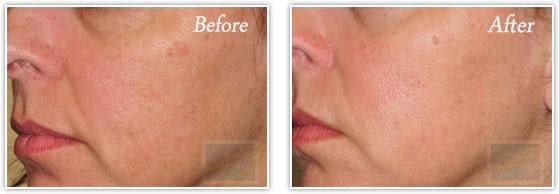 Lupo Center for Aesthetic and General Dermatology result — New Orleans, LA