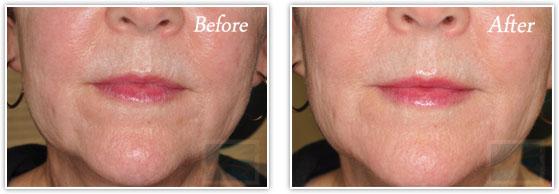 Lupo Center for Aesthetic and General Dermatology result — New Orleans, LA