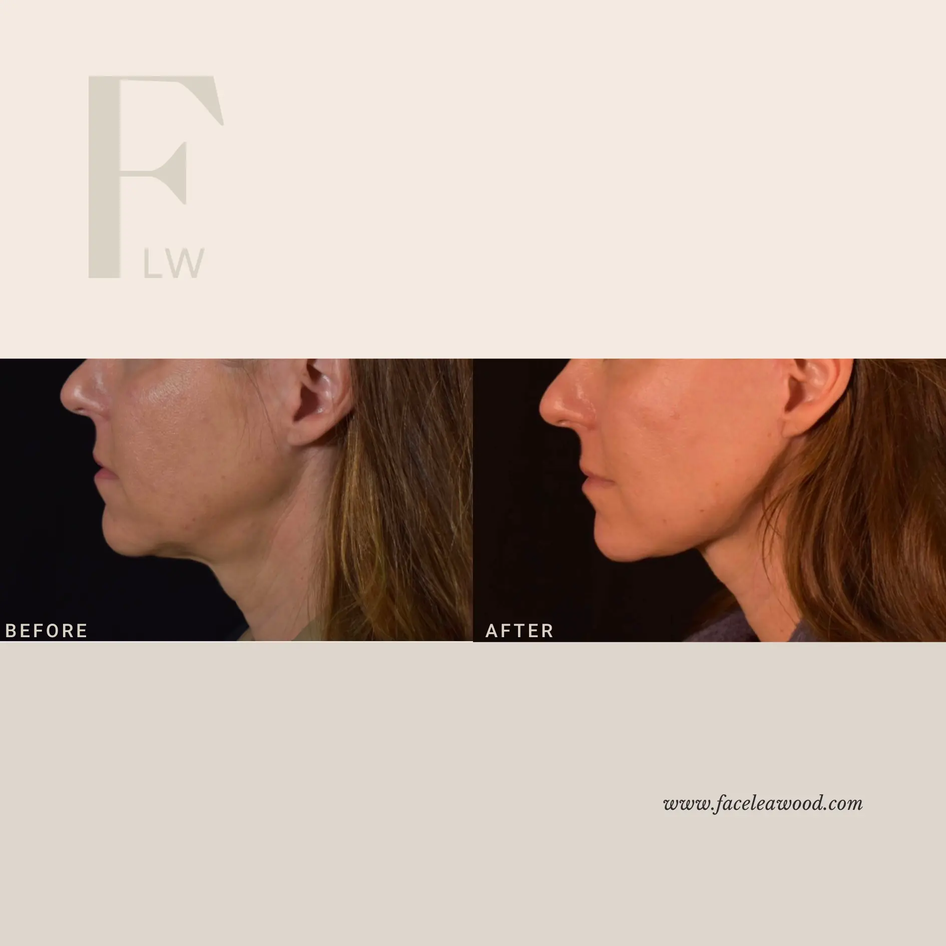 Dr. Lauren Umstattd result — Leawood, KS