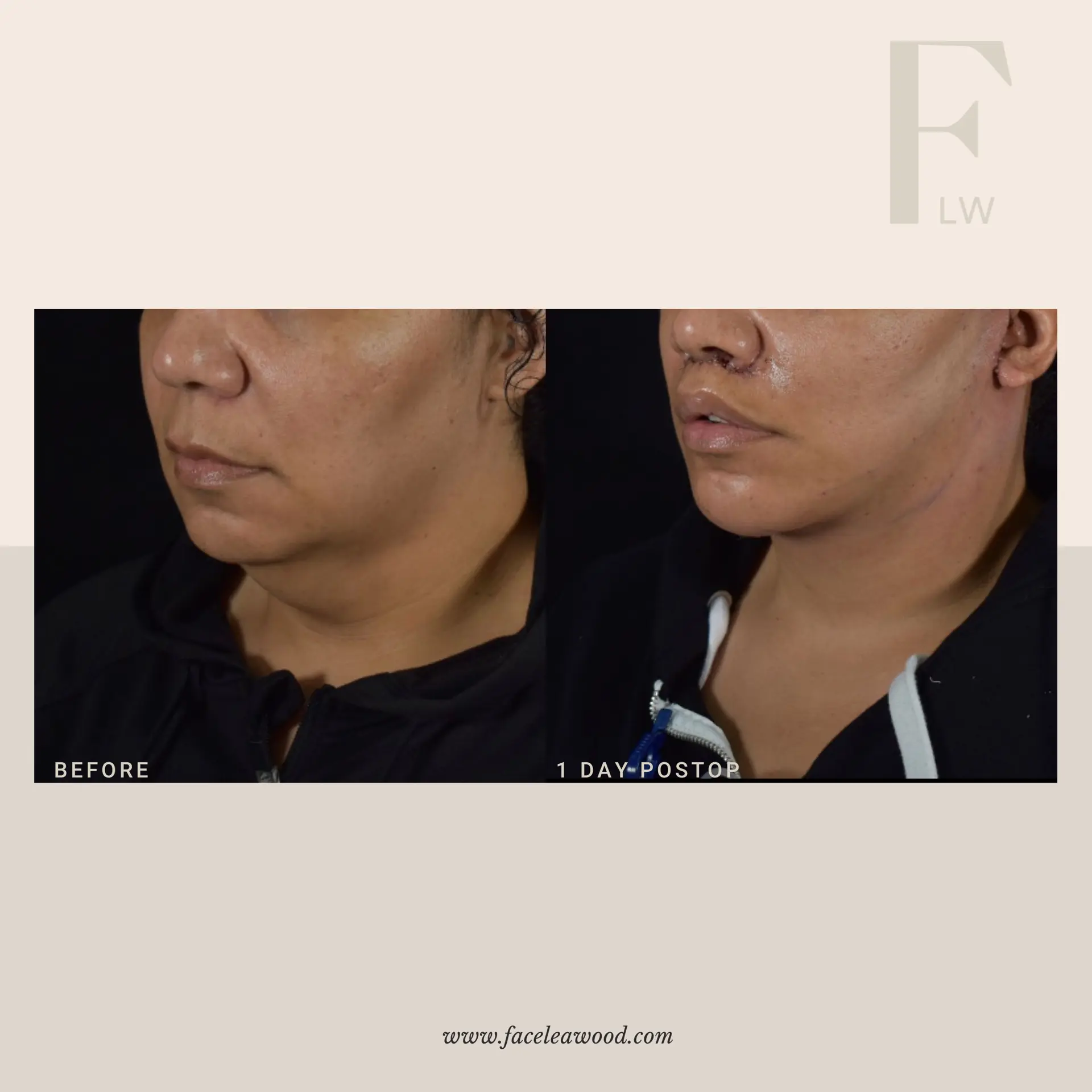Dr. Lauren Umstattd result — Leawood, KS