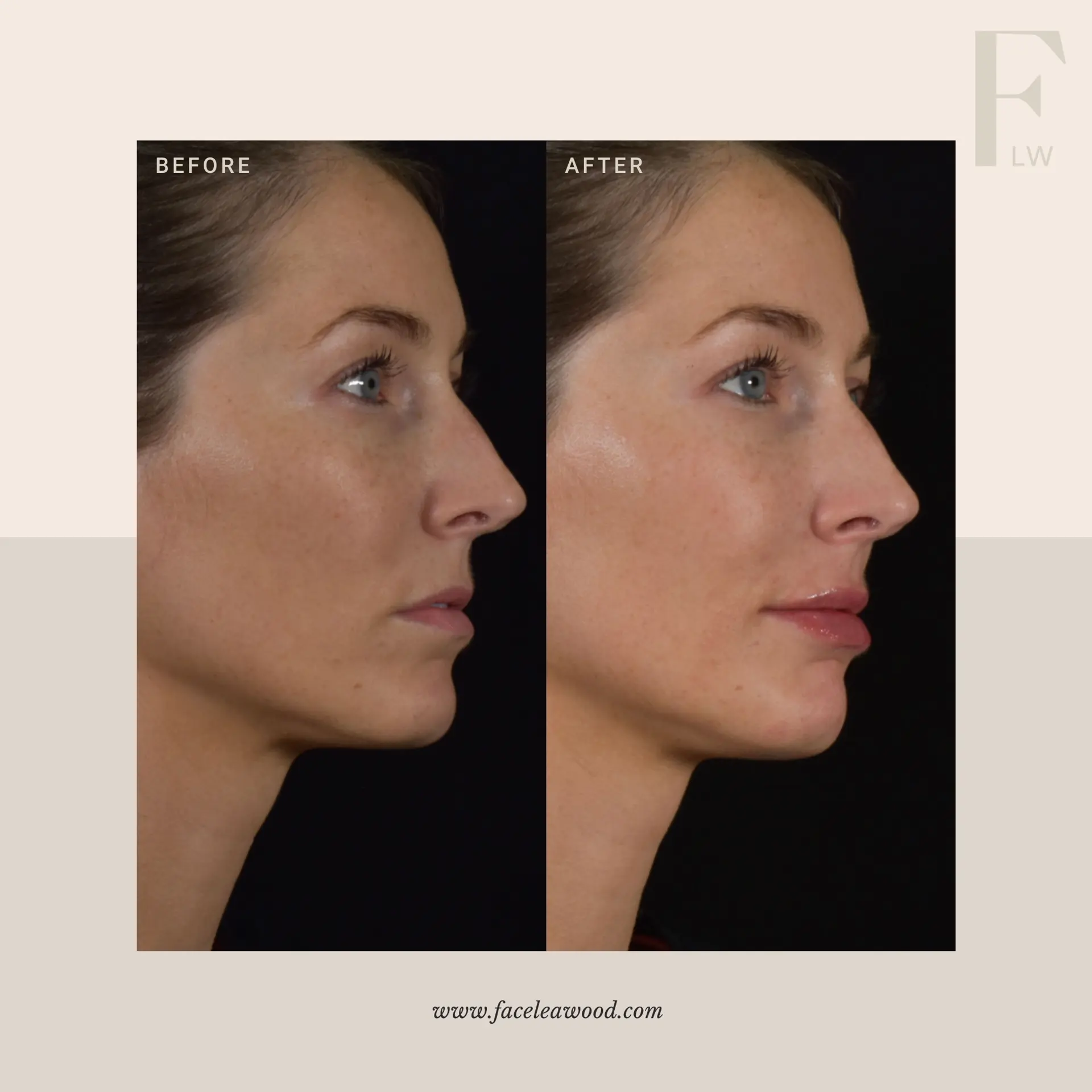 Dr. Lauren Umstattd result — Leawood, KS