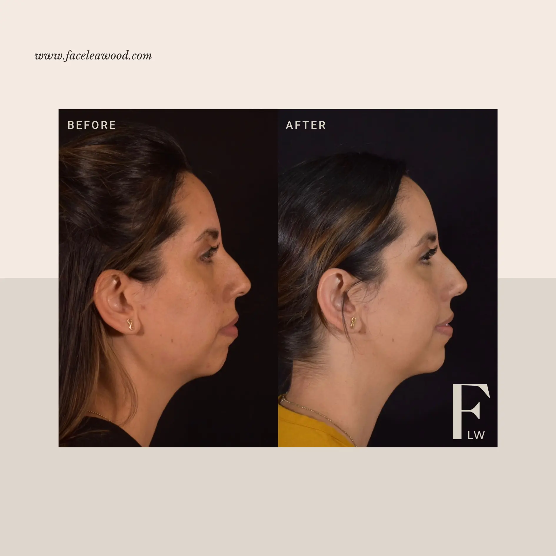 Dr. Lauren Umstattd result — Leawood, KS