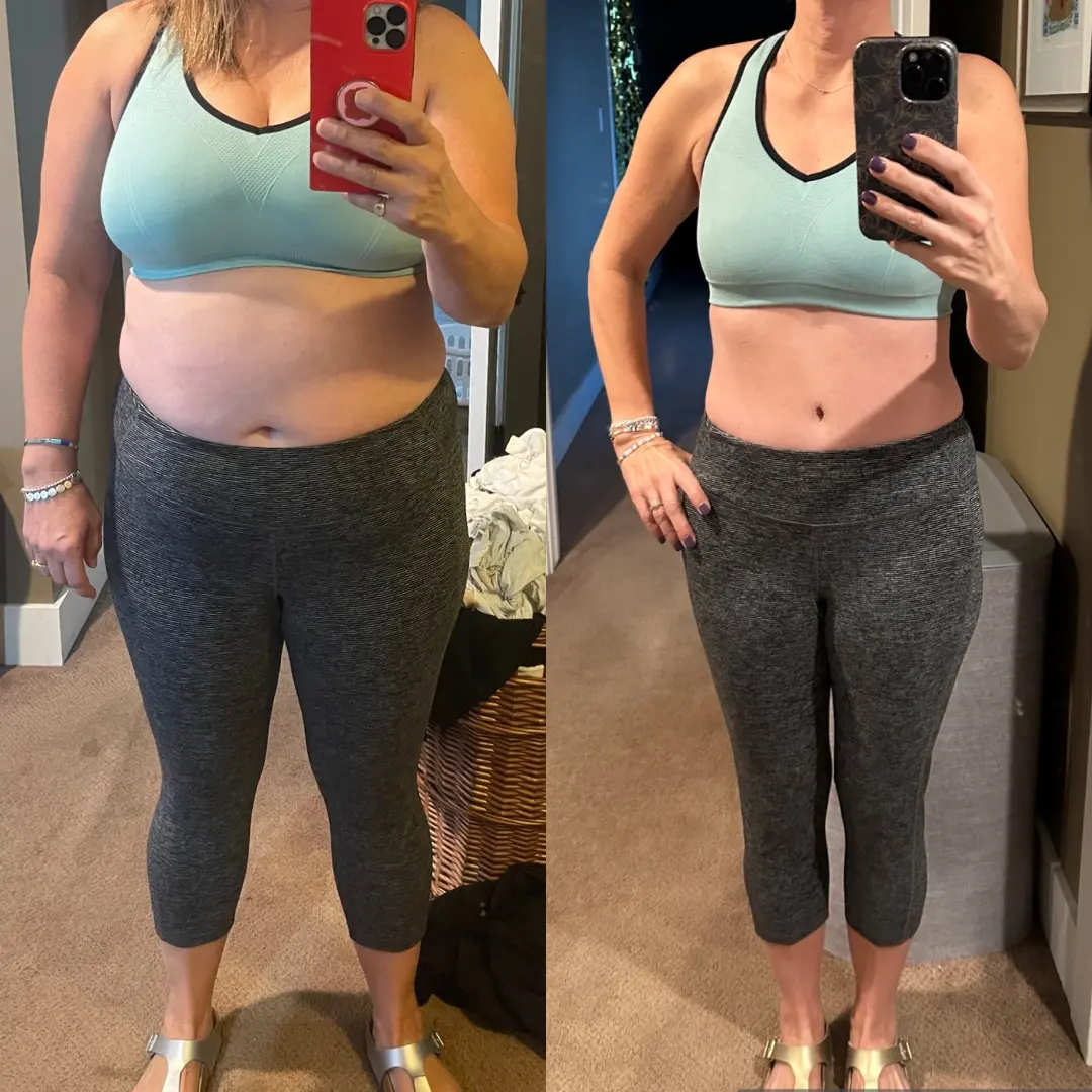 SLC Med Spa result — Draper, UT