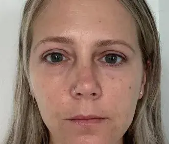The Skin Center after — Columbus, OH