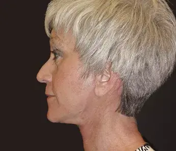 The Skin Center after — Columbus, OH