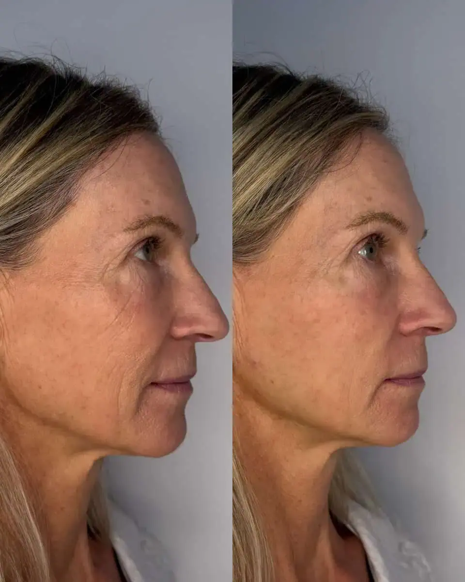KDR MedSpa + Wellness result — Boston, MA