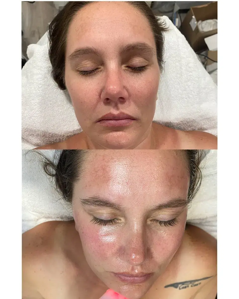 KDR MedSpa + Wellness result — Boston, MA