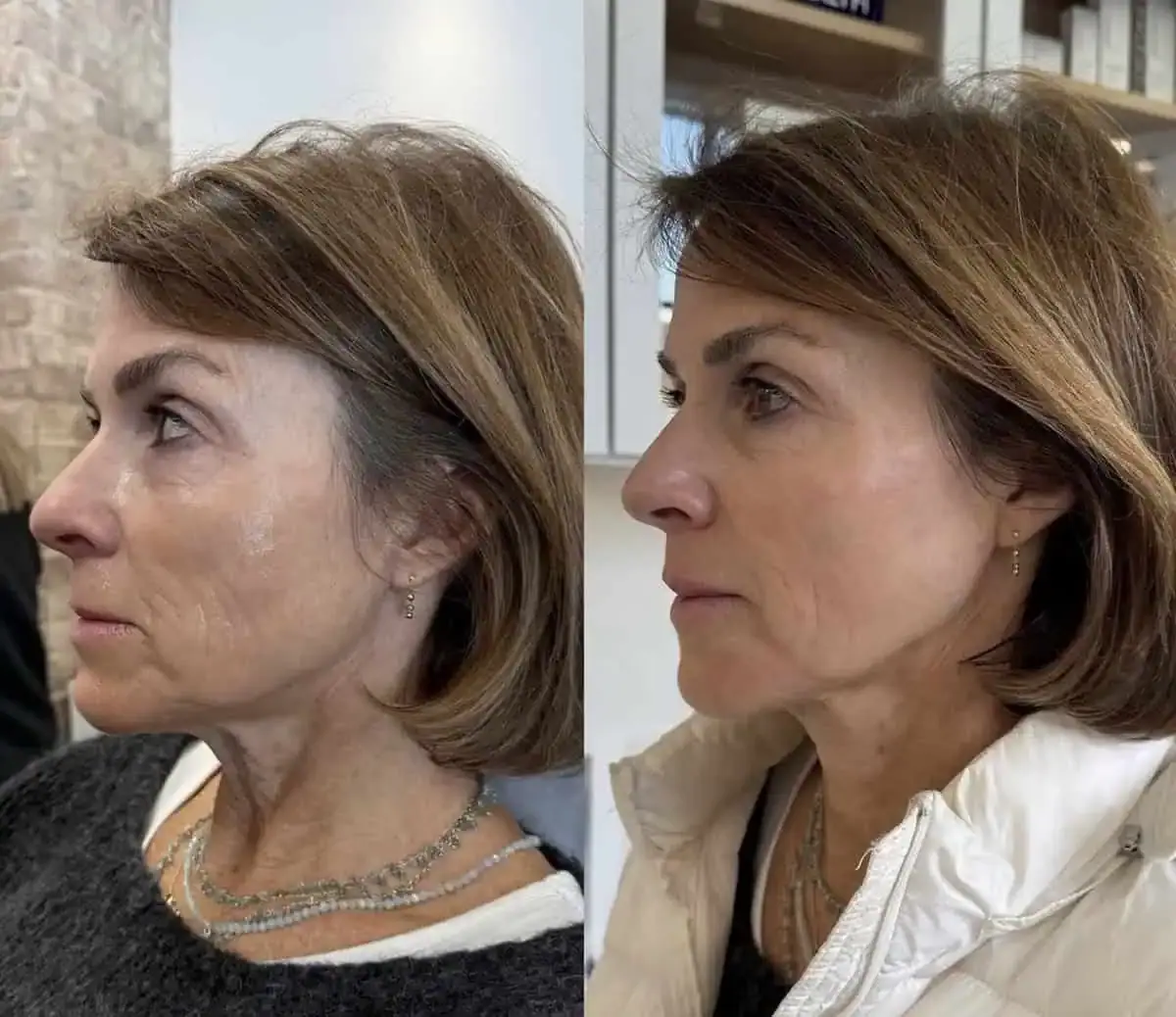KDR MedSpa + Wellness result — Boston, MA