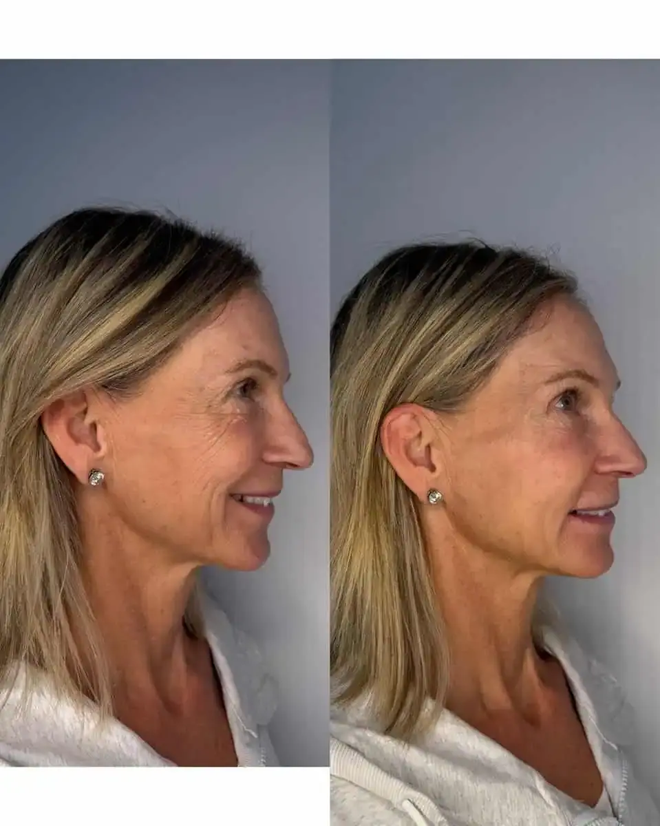 KDR MedSpa + Wellness result — Boston, MA