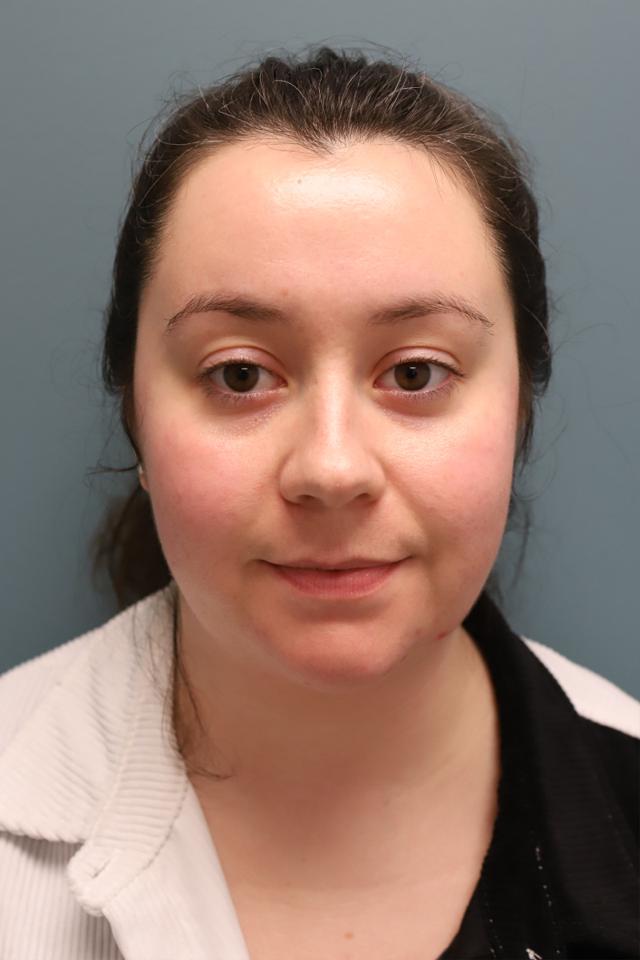 Liposuction before at The Lucas Center Cosmetic & Plastic Surgery in Knoxville, TN