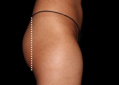 Applegate MedSpa after — Covington, KY