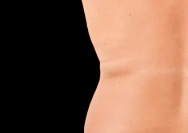 Applegate MedSpa after — Covington, KY