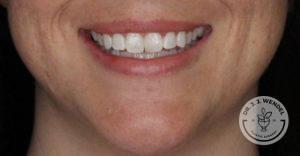 Dr. J. J. Wendel Plastic Surgery after — Nashville, TN