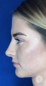 Dr. J. J. Wendel Plastic Surgery after — Nashville, TN