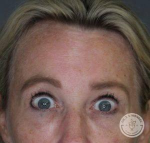 Dr. J. J. Wendel Plastic Surgery after — Nashville, TN