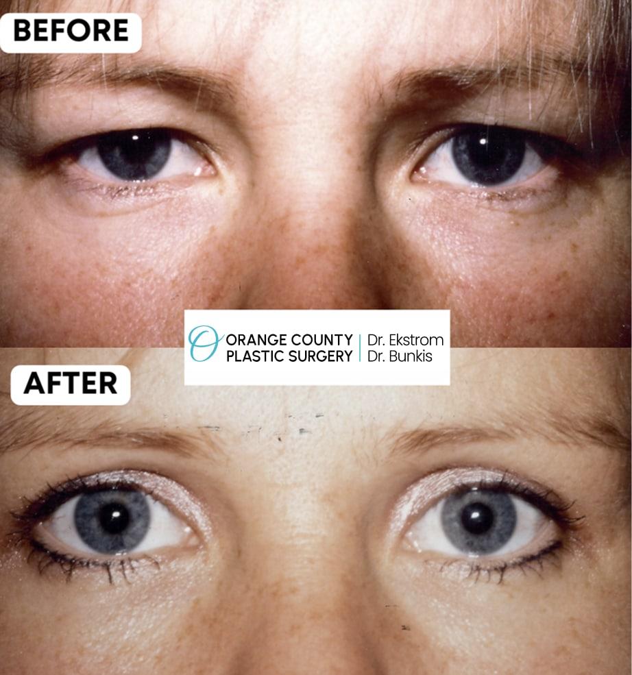 Juris Bunkis, MD result — Newport Beach, CA