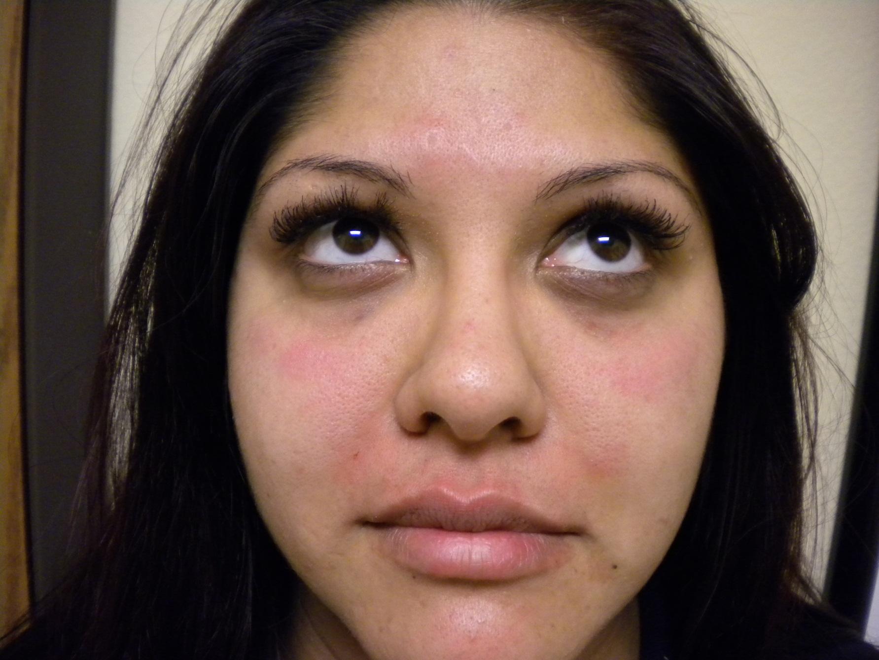 VIVA Medspa after — Plano, TX