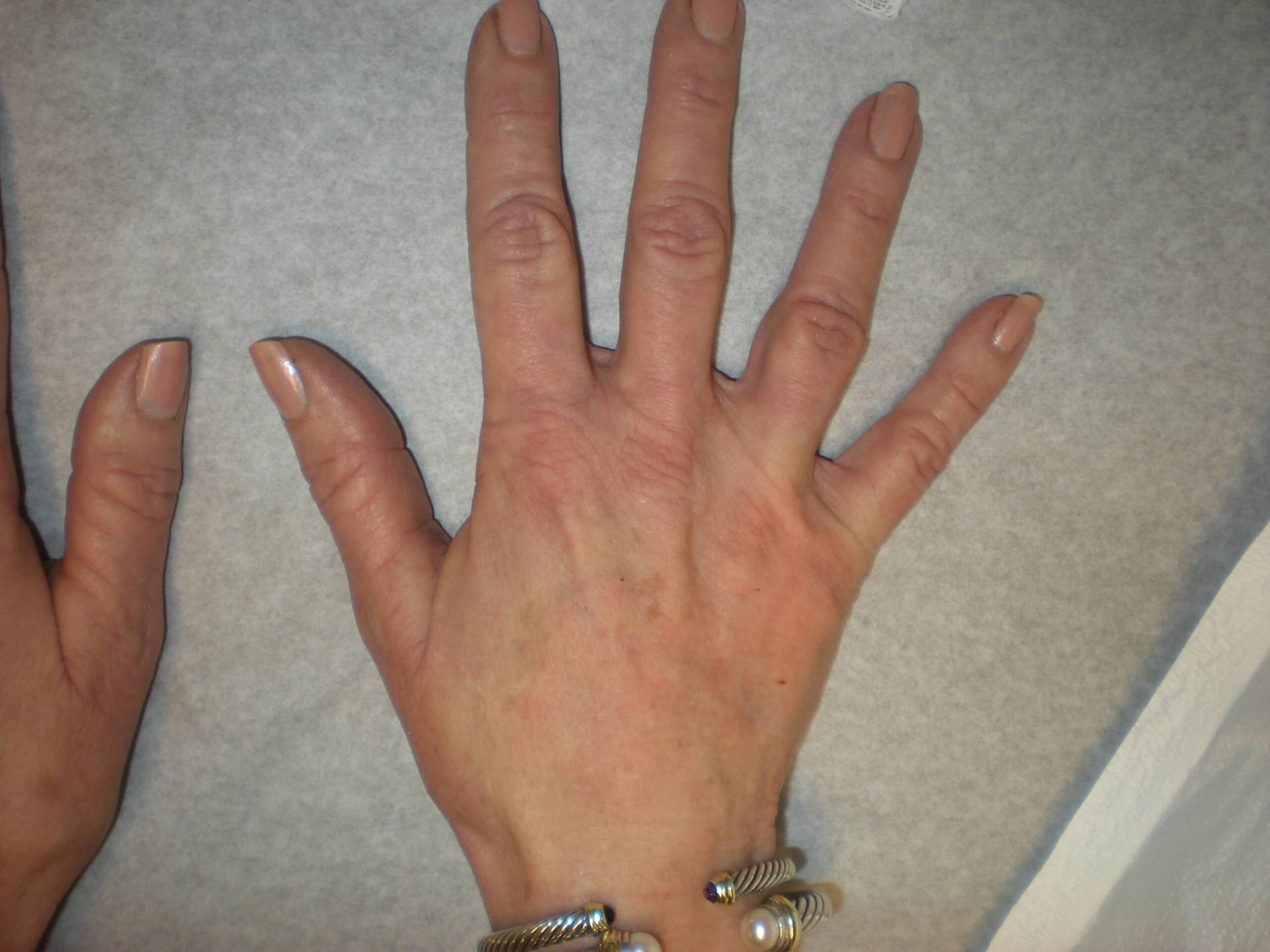 VIVA Medspa after — Plano, TX