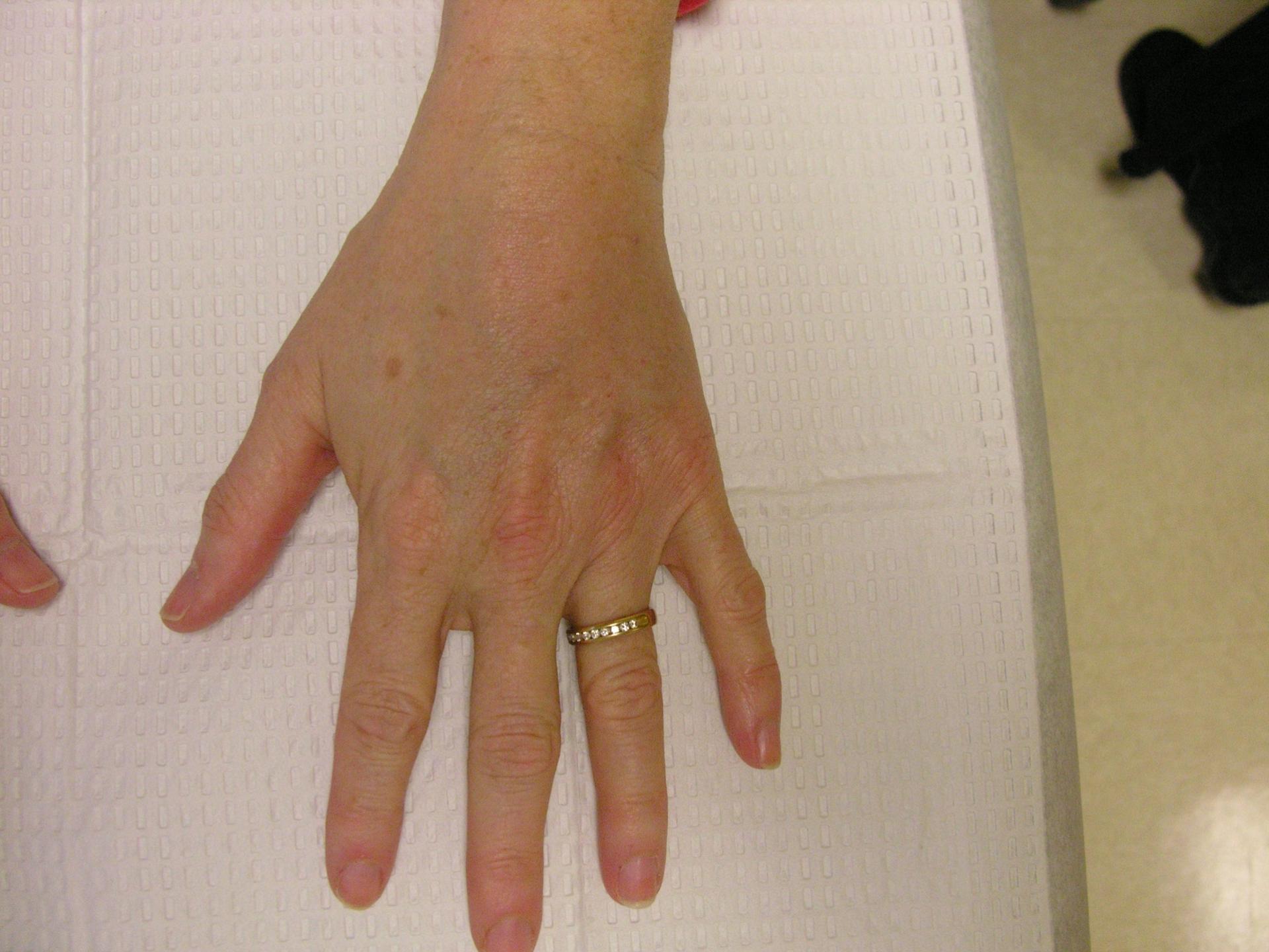 VIVA Medspa after — Plano, TX