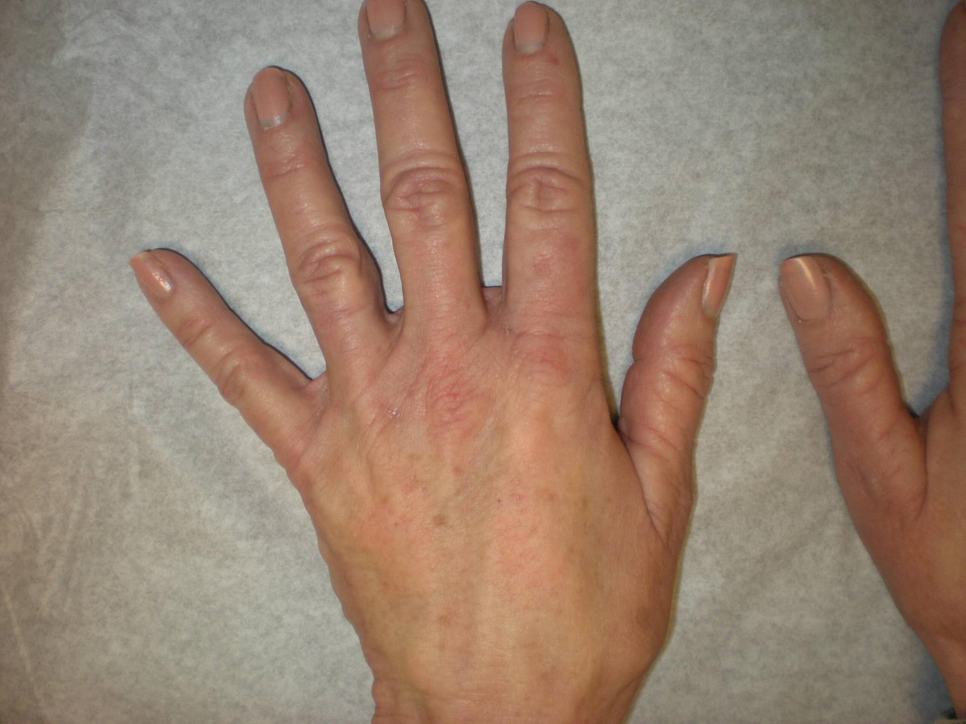 VIVA Medspa after — Plano, TX