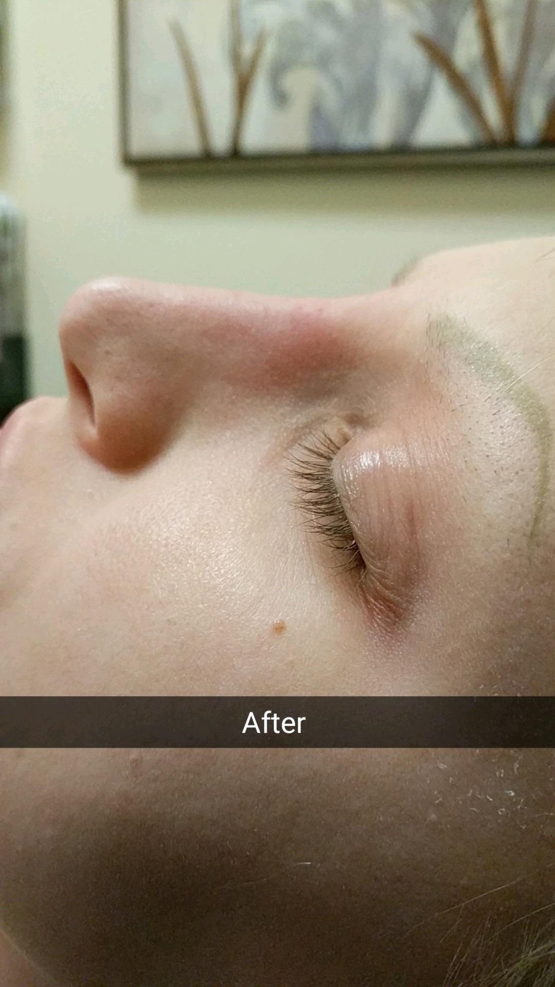 VIVA Medspa after — Plano, TX