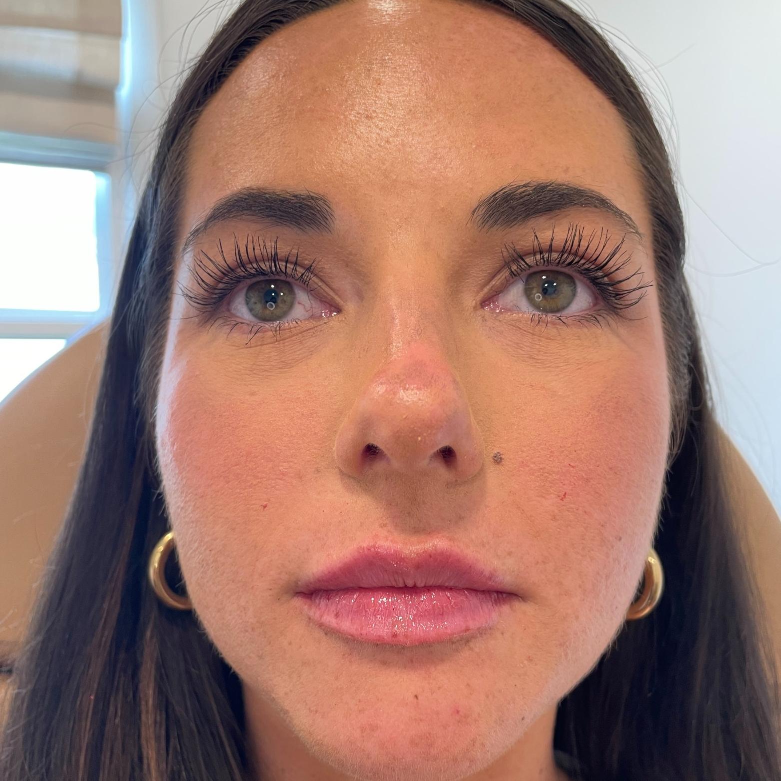 Stages Skin Studio after — Brentwood, TN