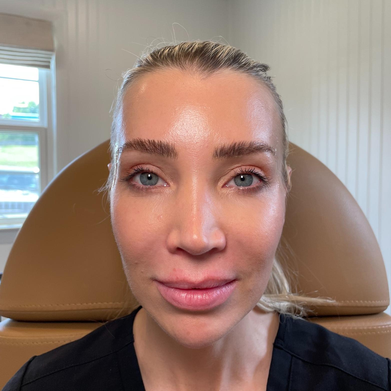 Stages Skin Studio after — Brentwood, TN