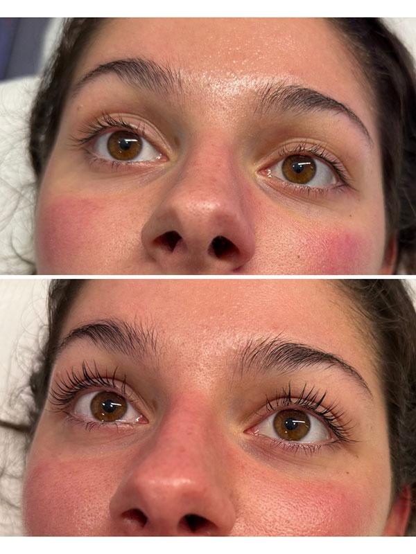 SkinCeuticals SkinLab Charleston result — Charleston, SC