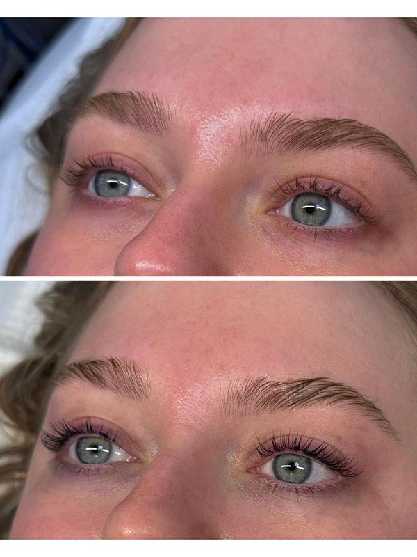 SkinCeuticals SkinLab Charleston result — Charleston, SC