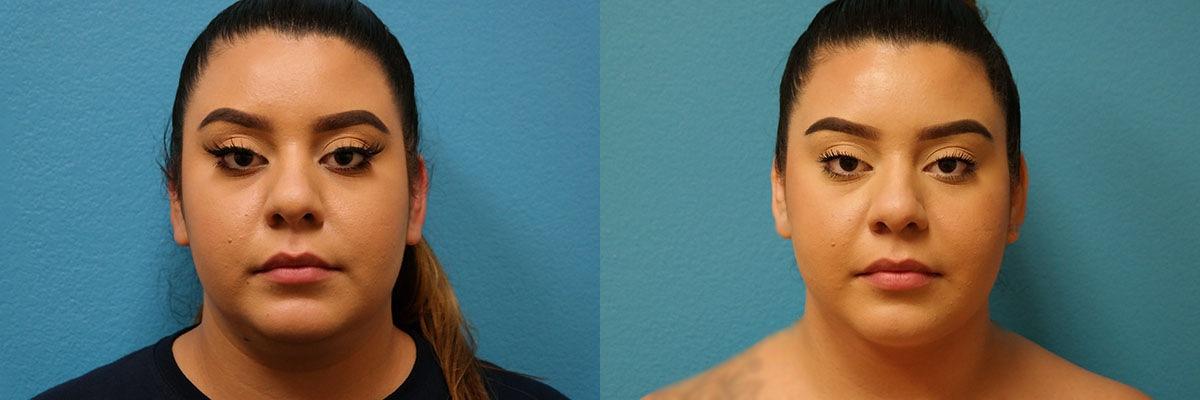 Dr. Candis Lovelace, MD, FACS result — Keller, TX
