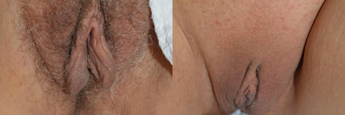 Dr. Candis Lovelace, MD, FACS result — Keller, TX