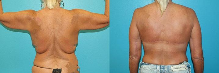Dr. Candis Lovelace, MD, FACS result — Keller, TX