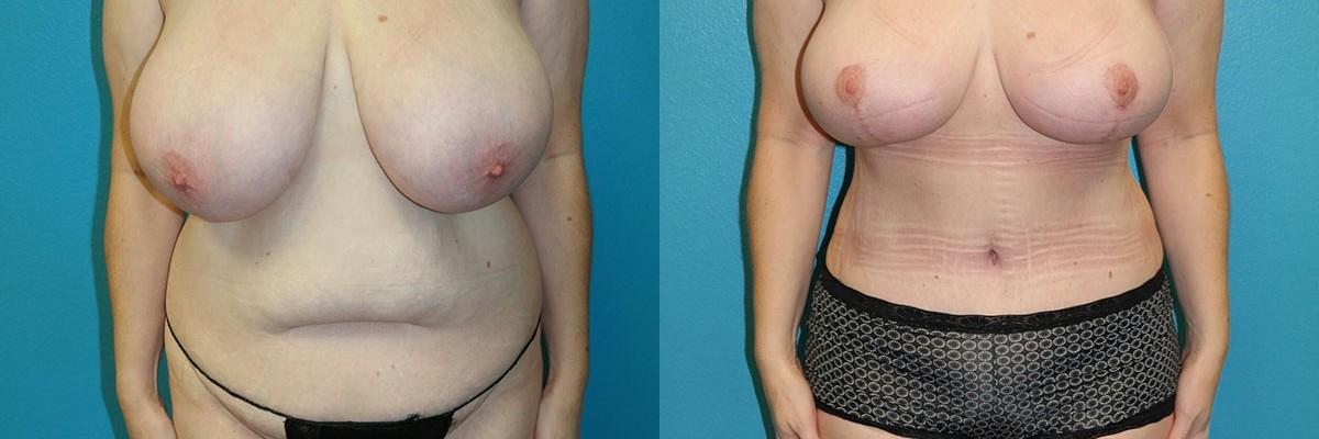 Dr. Candis Lovelace, MD, FACS result — Keller, TX