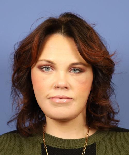 Bitner Facial Plastic Surgery of Utah facelift after — Salt Lake City, UT