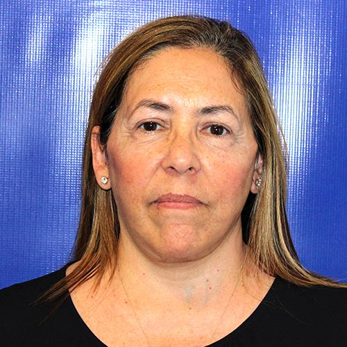 Farber Plastic Surgery facelift after — Delray Beach, FL